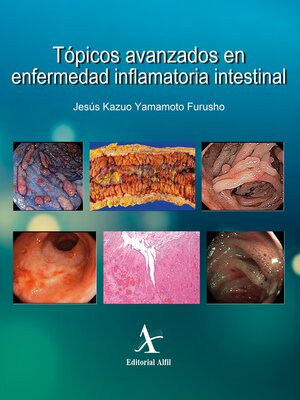 cover image of Tópicos avanzados en enfermedad inflamatoria intestinal